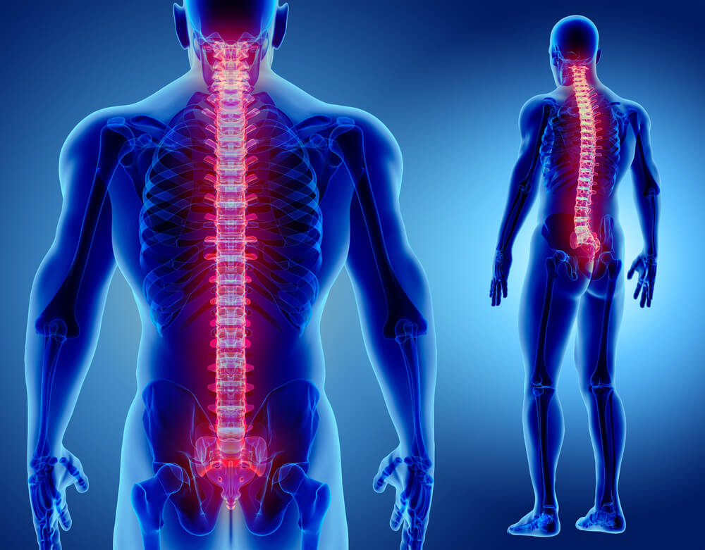 Spinal cord stimulation doesn t help with back pain says new review - The  University of Sydney